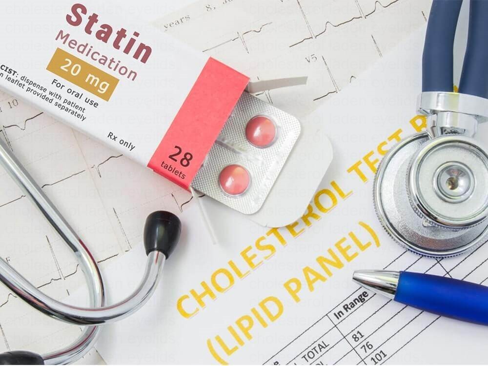 Cholesterol eye bumps on the eyelid skin problems
