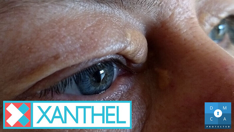 Pictures of xanthelasma around the eyelids