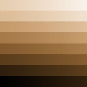 xanthelasma skin tone 1
