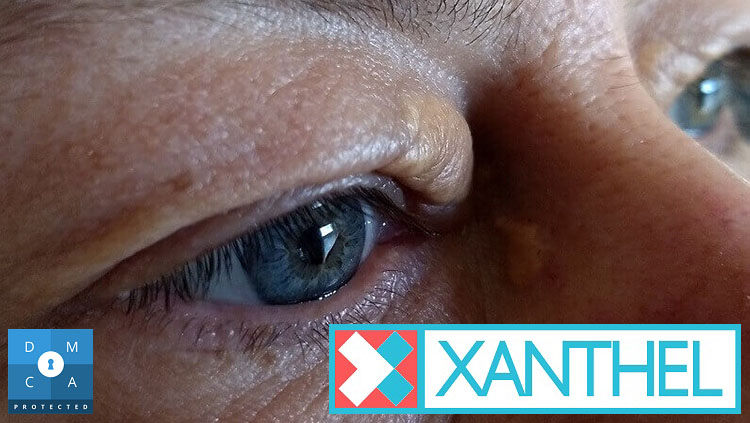 Xanthomatosis images showing yellow deposits around the eye