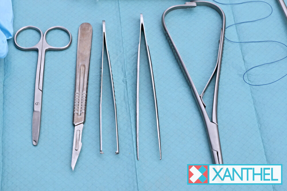 Xanthelasma surgical removal for larger patches