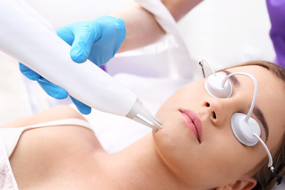 Xanthelasma laser removal in a clinic
