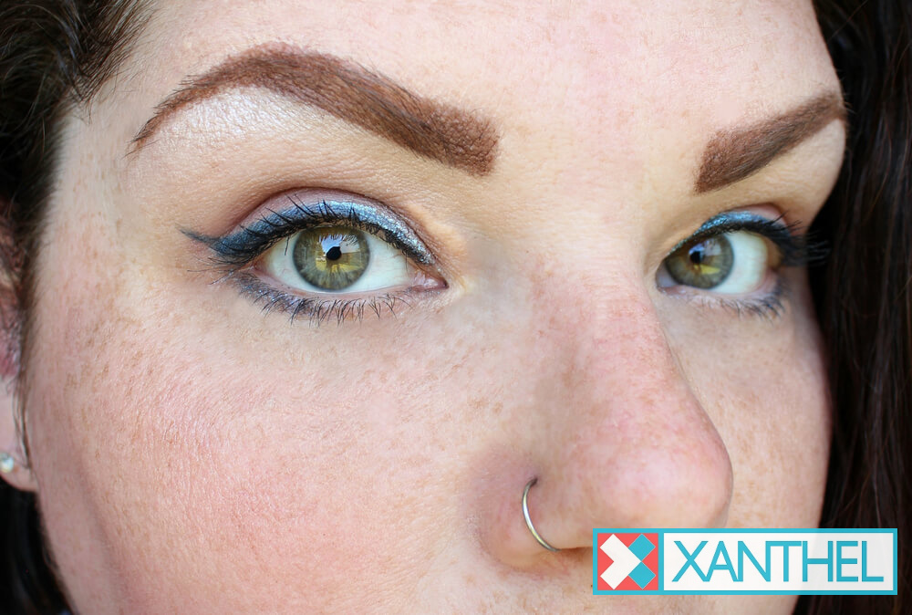 Xanthelasma before removal